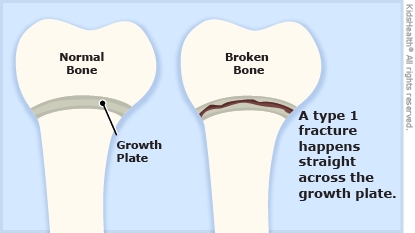 KidsHealth Image