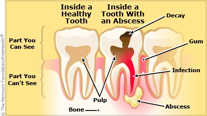 KidsHealth Image