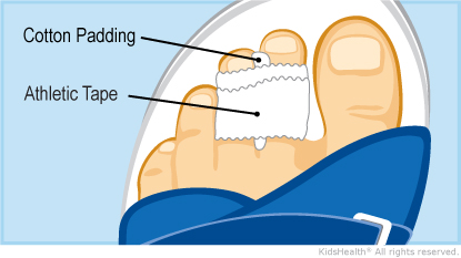 KidsHealth Image