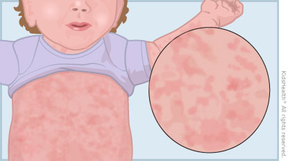 KidsHealth Image