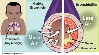 KidsHealth Image