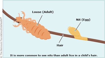 KidsHealth Image