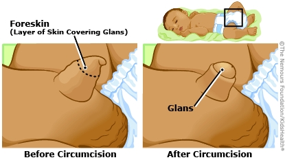 KidsHealth Image