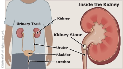 KidsHealth Image