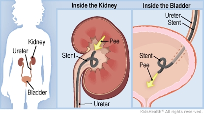 KidsHealth Image