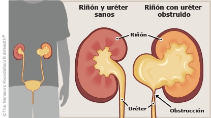 KidsHealth Image