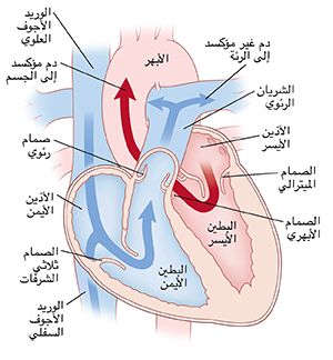 صورة أمامية لمقطع عرضي للقلب توضح الشريان الأبهر الطبيعي، والشريان الرئوي الطبيعي، والصمام التاجي الطبيعي، والصمام الأبهري الطبيعي، والأذين الأيسر الطبيعي، والبطين الأيسر الطبيعي، والأذين الأيمن الطبيعي، والبطين الأيمن الطبيعي، والصمام ثلاثي الشرف الطبيعي، والصمام الرئوي الطبيعي، والوريد الأجوف العلوي الطبيعي، والوريد الأجوف السفلي الطبيعي. أسهم على الجانب الأيمن من القلب توضح ضخ الدم المفتقر للأكسجين إلى الرئتين. أسهم على الجانب الأيسر من القلب توضح ضخ الدم الغني بالأكسجين إلى الجسم.