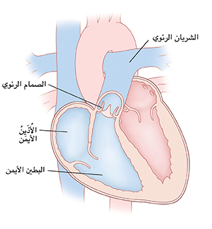 مقطع عرضي للقلب يظهر فيه الشريان الرئوي، والصمام الرئوي، والأذين الأيمن، والبطين الأيمن.