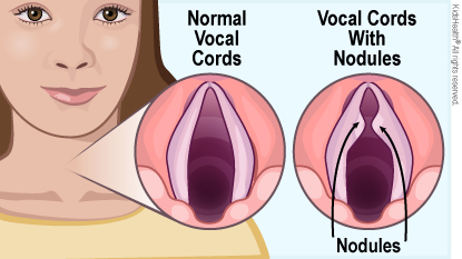 KidsHealth Image