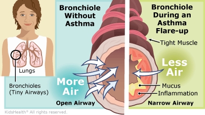 KidsHealth Image